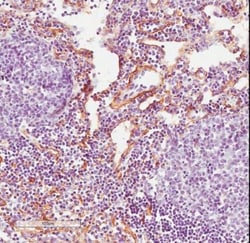 Fibroblast Antibody (ER-TR7) - BSA Free, Novus Biologicals 0.125mg; Unlabeled:Antibodies,